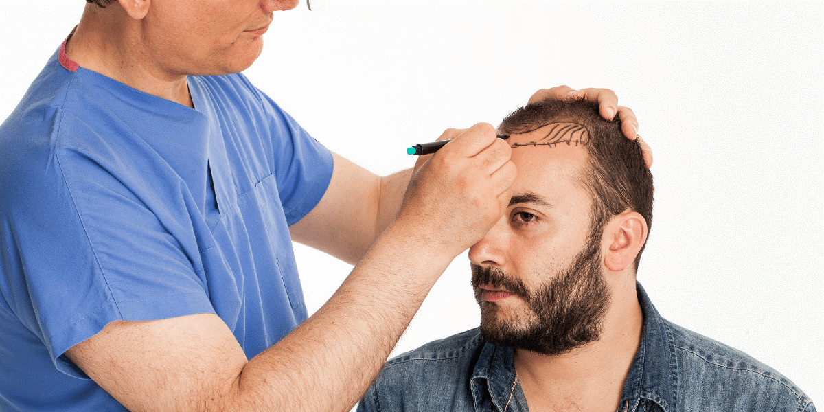 los angeles fue hair transplant clinic