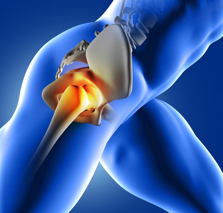 The Impact of Meniscus Tears on Your Life: How Surgery Can Help